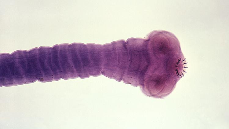 Tratamento medicamentoso da neurocisticercose: quando e como tratar?