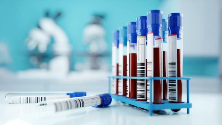 RDC 978/2025: principais pontos para os serviços de Exames de Análises Clínicas