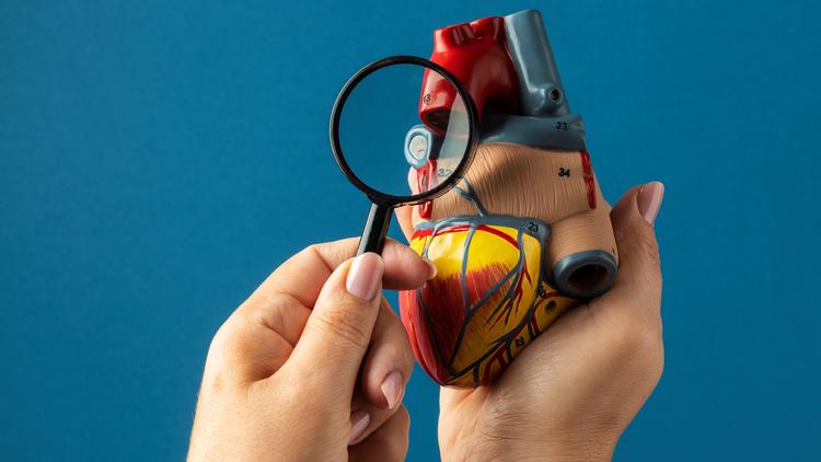 Há benefício do rastreamento com escore de cálcio coronário em assintomáticos?