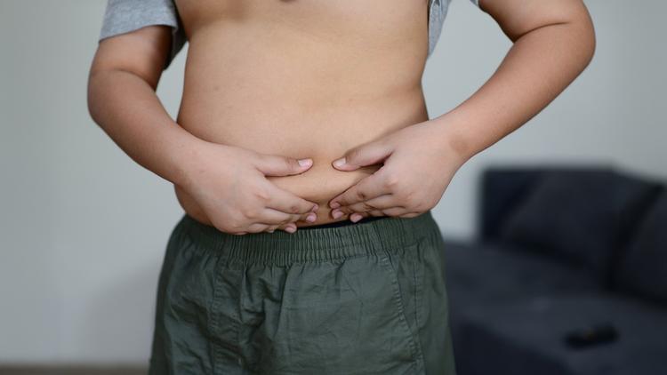 obesidade infantil