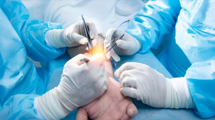 A técnica WALANT pode substituir os bloqueios regionais em cirurgia da mão?