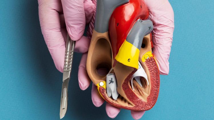 Troca valvar na estenose aórtica grave assintomática