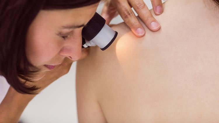 Caso clínico: Dermatoscopia ajuda no diagnóstico de doença do tecido conjuntivo?