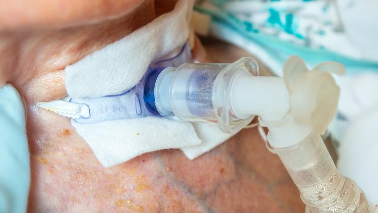 Traqueostomia precoce versus tardia em pacientes com trauma múltiplo