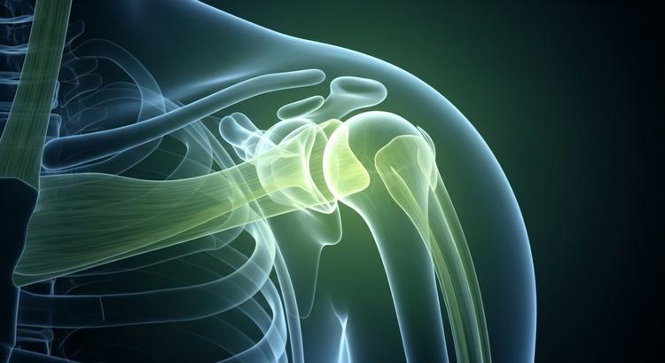 tratamento de fraturas de úmero