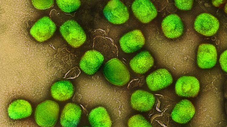 Persistência de anticorpos contra mpox após infecção comparada com vacinação