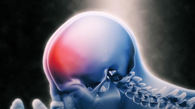 Hipertensão intracraniana idiopática: Topiramato ou acetazolamida?