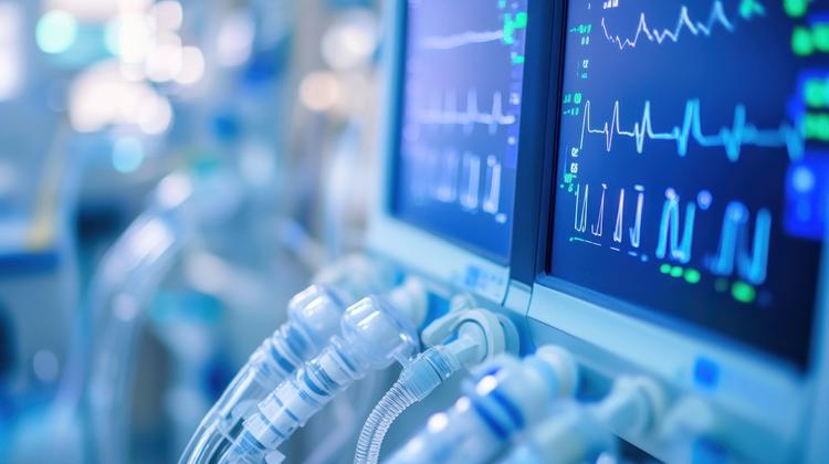 Ventilação Mecânica Protetora Cerebral