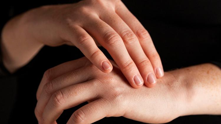 Caso clínico: Manchas brancas e o papel da luz de wood no diagnóstico