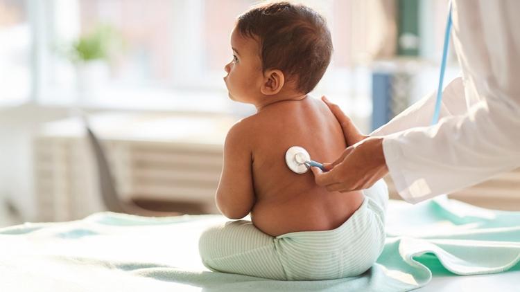 CNAF em crianças internadas com bronquiolite