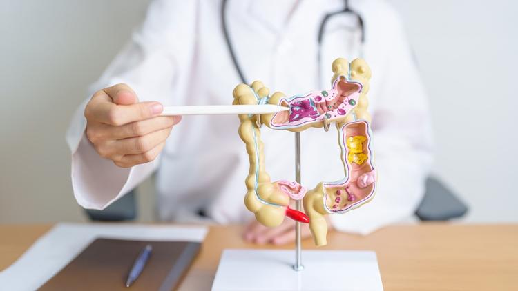 Diretrizes da EAES para o tratamento cirúrgico da diverticulite complicada