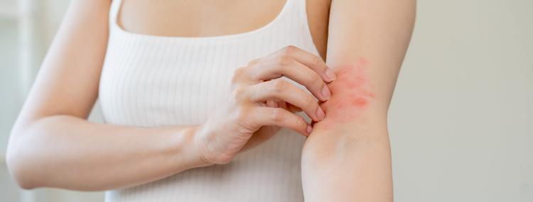 Corticosteroides tópicos e estratégias de manejo das dermatoses inflamatórias