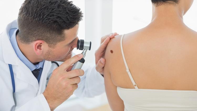 Melanoma Lentiginoso Acral: evidências recentes e desafios terapêuticos