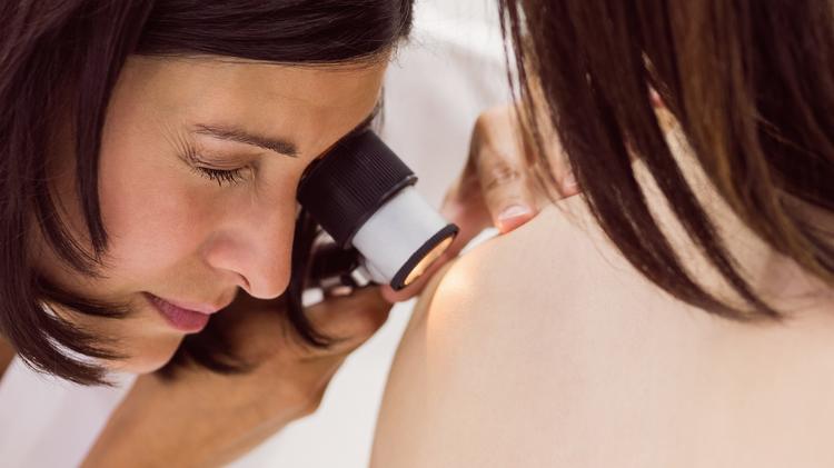 Verrugas cutâneas: Uma análise comparativa de diferentes modalidades de tratamento