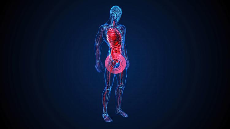 ressonância e biópsia