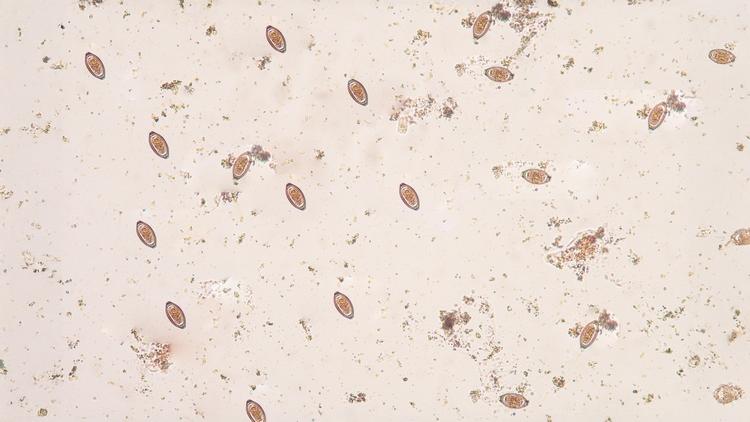 Esquistossomose Humana: Panorama Atual