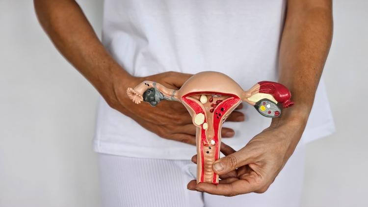 Histerectomia vaginal versus laparoscópica