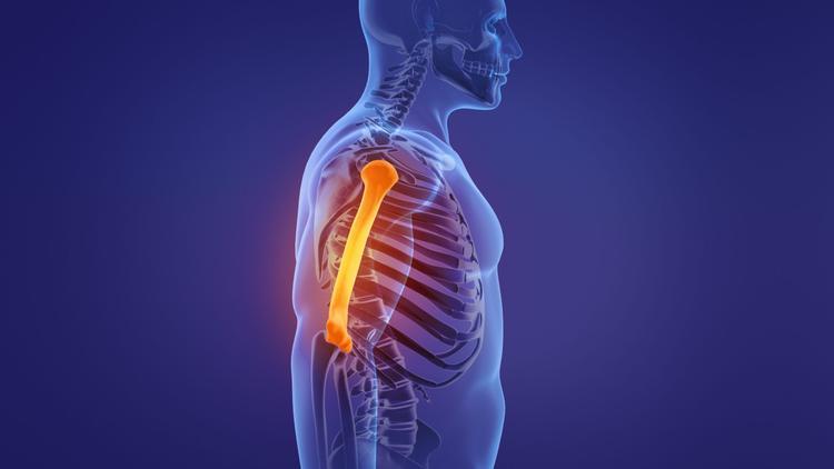 Construção paralela ou ortogonal no tratamento das fraturas de úmero distal?