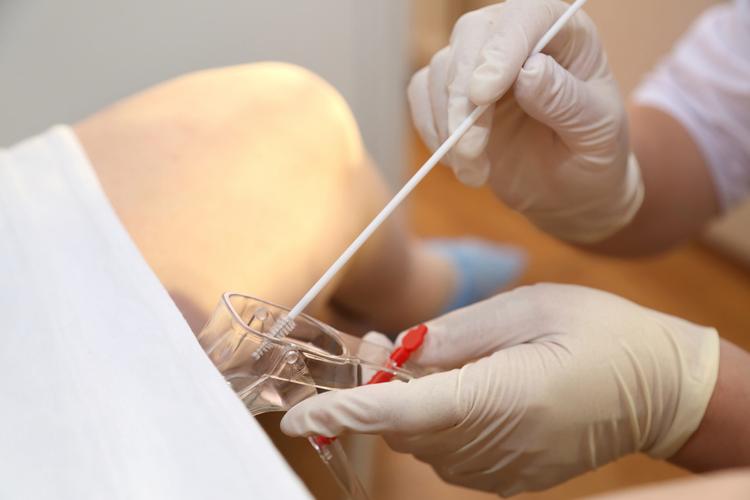 Terapias tópicas para HPV: entre a expectativa e a evidência clínica