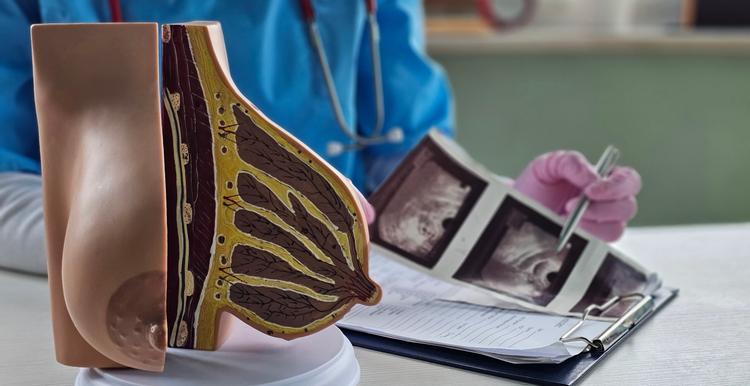 Diretrizes ASBrS/SBI/CAP para lesões infecciosas e inflamatórias da mama