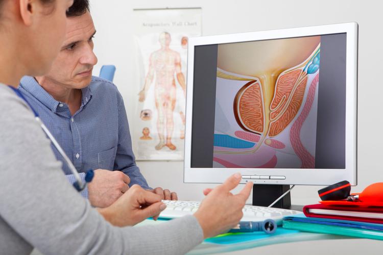 Atualização 2026 da Sociedade de Radiologia para embolização prostática arterial