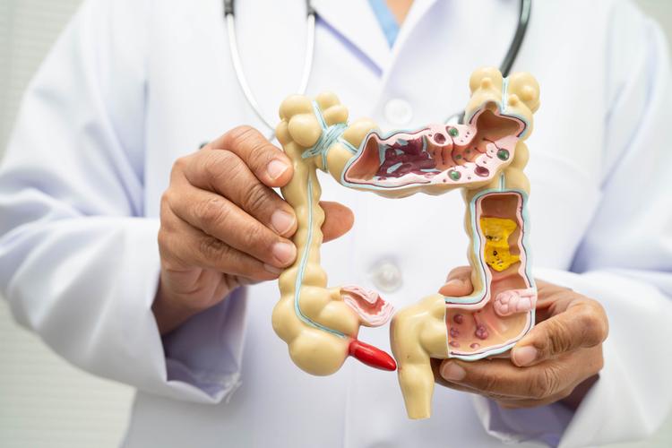 Brida intestinal: sintomas, diagnóstico e tratamento da obstrução por aderências