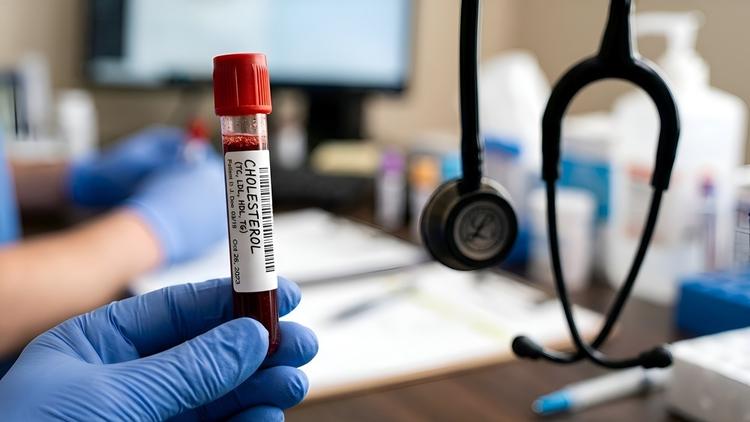evolocumabe na prevenção primária