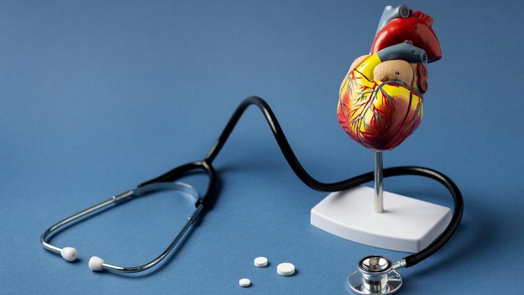 O escore de cálcio é útil para pacientes com lipoproteína(a) aumentada