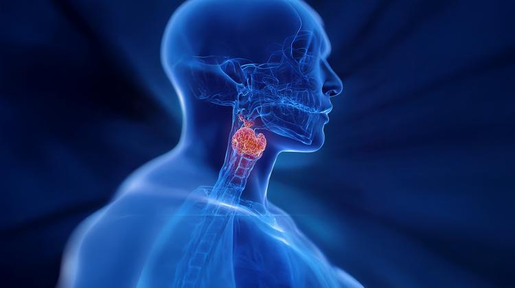 Pembrolizumabe (Keytruda®) para pacientes com câncer de cabeça e pescoço avançado