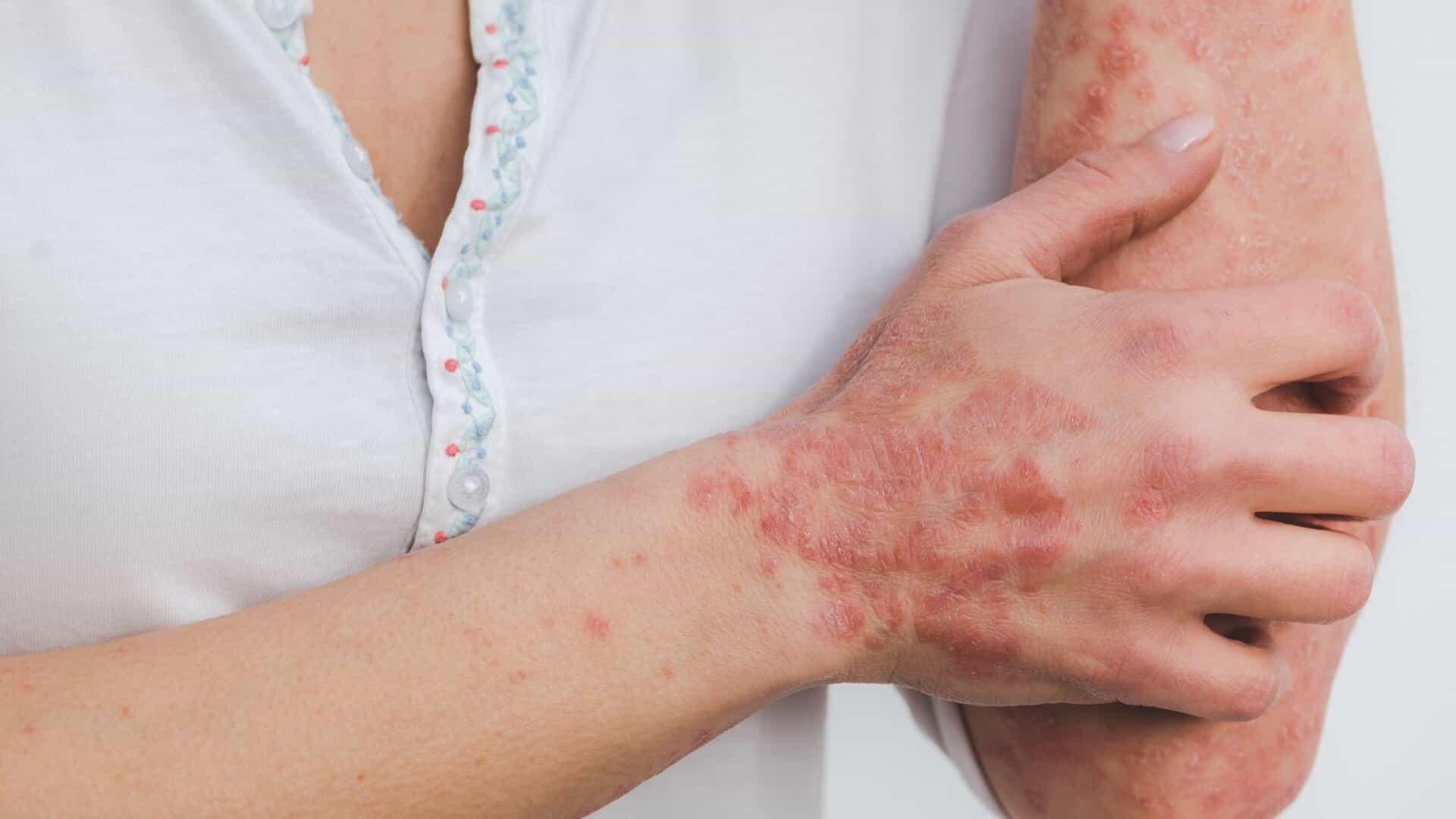 Capa do artigo