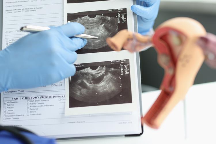 US transvaginal